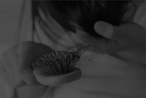 白髪・薄毛・抜け毛